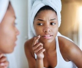 7 Effective Home Remedies To Treat Acne